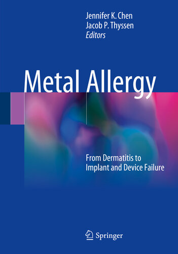 Metal Allergy: From Dermatitis to Implant and Device Failure 2018