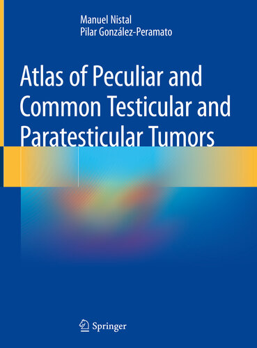 Atlas of Peculiar and Common Testicular and Paratesticular Tumors 2019