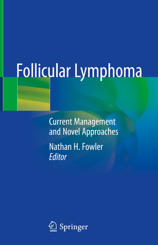 Follicular Lymphoma: Current Management and Novel Approaches 2019