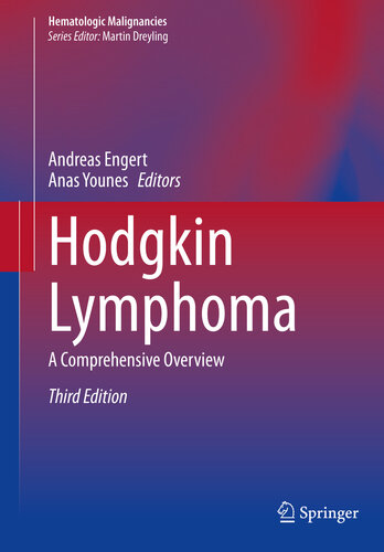 Hodgkin Lymphoma: A Comprehensive Overview 2020