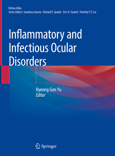 Inflammatory and Infectious Ocular Disorders 2019