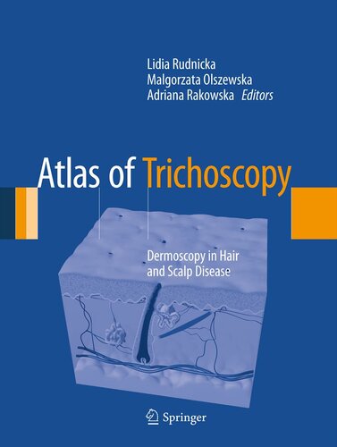 Atlas of Trichoscopy: Dermoscopy in Hair and Scalp Disease 2014