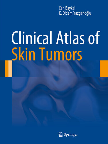 Clinical Atlas of Skin Tumors 2014