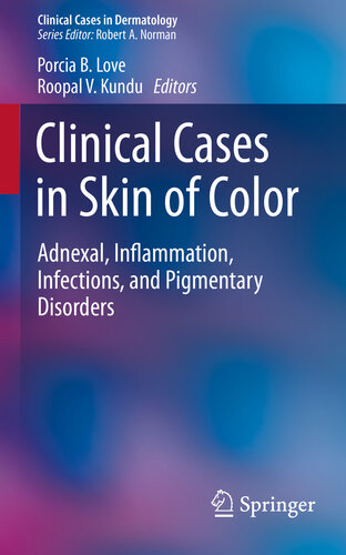 Clinical Cases in Skin of Color: Adnexal, Inflammation, Infections, and Pigmentary Disorders 2015