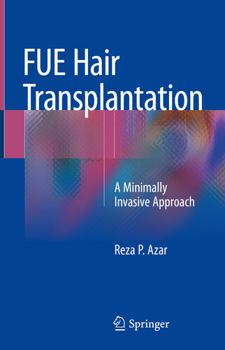 FUE Hair Transplantation: A Minimally Invasive Approach 2018