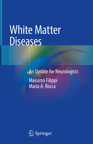 بیماری های ماده سفید: به روز رسانی برای متخصصان مغز و اعصاب