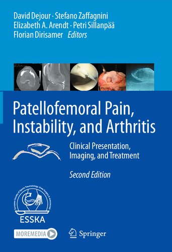 Patellofemoral Pain, Instability, and Arthritis: Clinical Presentation, Imaging, and Treatment 2020