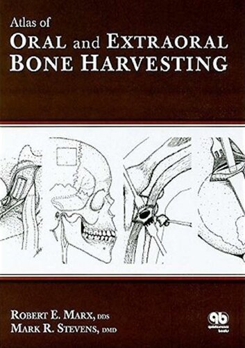 Atlas of Oral and Extraoral Bone Harvesting 2010