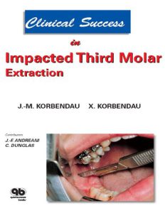 موفقیت بالینی در کشیدن دندان مولر سوم آسیب دیده
