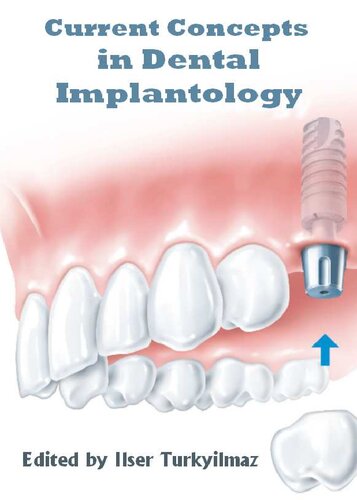 Current Concepts in Dental Implantology 2015