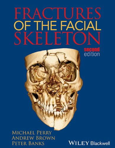 Fractures of the Facial Skeleton 2015