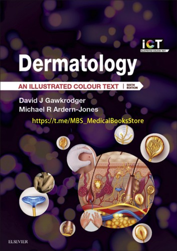 Dermatology E-Book: An Illustrated Colour Text 2016