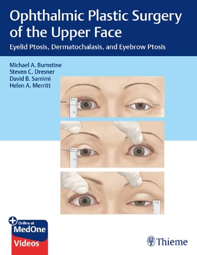 Ophthalmic Plastic Surgery of the Upper Face: Eyelid Ptosis, Dermatochalasis, and Eyebrow Ptosis 2019