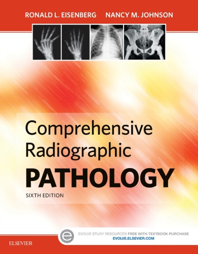 Comprehensive Radiographic Pathology - E-Book 2015
