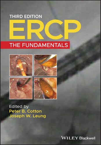 ERCP: The Fundamentals 2020