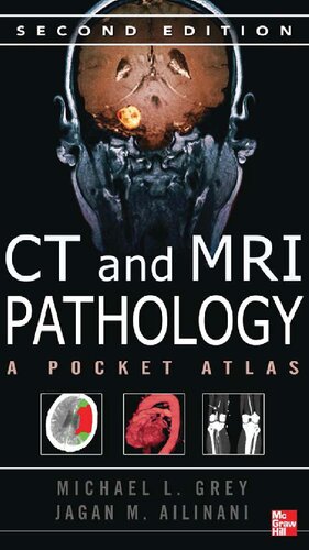 CT & MRI Pathology: A Pocket Atlas, Second Edition 2012
