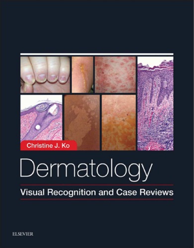 پوست: کتاب الکترونیکی تشخیص بصری و بررسی موارد