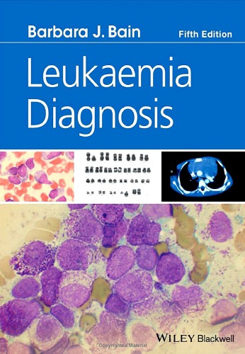 Leukaemia Diagnosis 2017