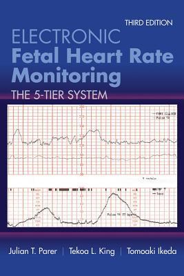 Electronic Fetal Heart Rate Monitoring 2017