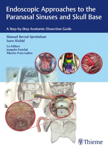 Endoscopic Approaches to the Paranasal Sinuses and Skull Base: A Step-by-Step Anatomic Dissection Guide 2017