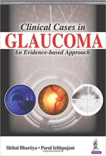 Clinical Cases in Glaucoma: An Evidence Based Approach 2017