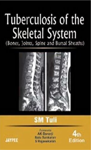 Tuberculosis of the Skeletal System: Bones, Joints, Spine and Bursal Sheaths 2008