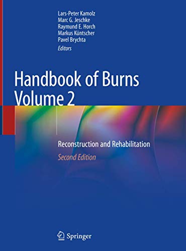 Handbook of Burns Volume 2: Reconstruction and Rehabilitation 2020