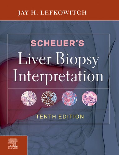 Scheuer's Liver Biopsy Interpretation 2020