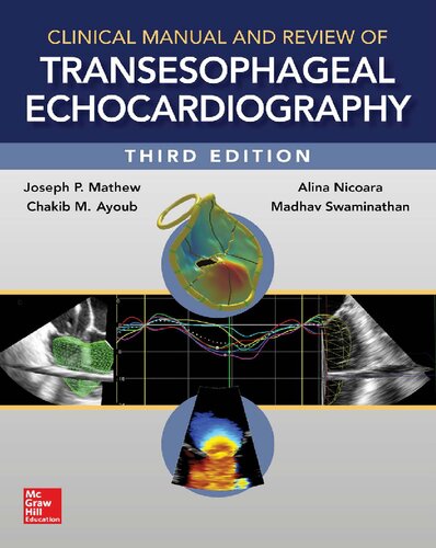 Clinical Manual and Review of Transesophageal Echocardiography, 3/e 2019