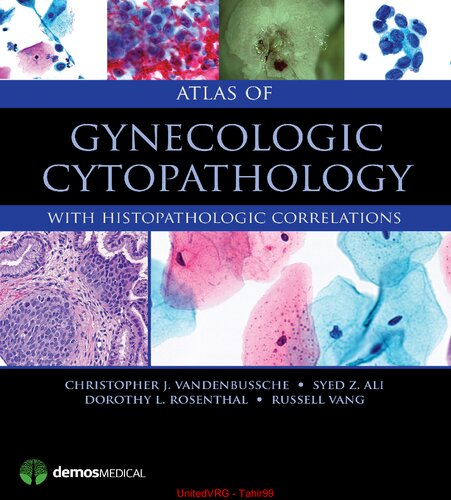 Atlas of Gynecologic Cytopathology: With Histopathologic Correlations 2015