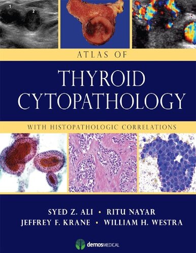 Atlas of Thyroid Cytopathology: With Histopathologic Correlations 2013