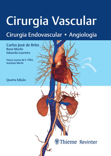 Cirurgia Vascular: Cirurgia Endovascular - Angiologia 2020