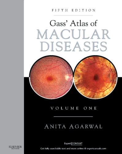 Gass' Atlas of Macular Diseases 2011