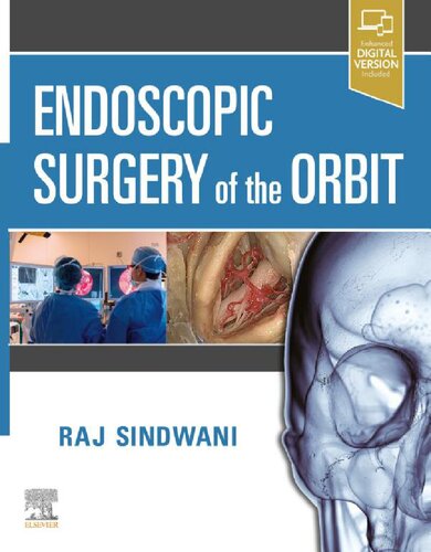 Endoscopic Surgery of the Orbit E-Book 2020