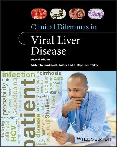 Clinical Dilemmas in Viral Liver Disease 2020