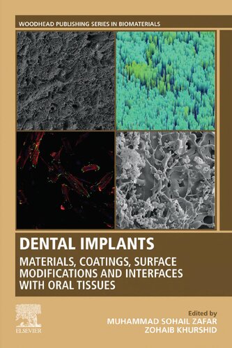 Dental Implants: Materials, Coatings, Surface Modifications and Interfaces with Oral Tissues 2020