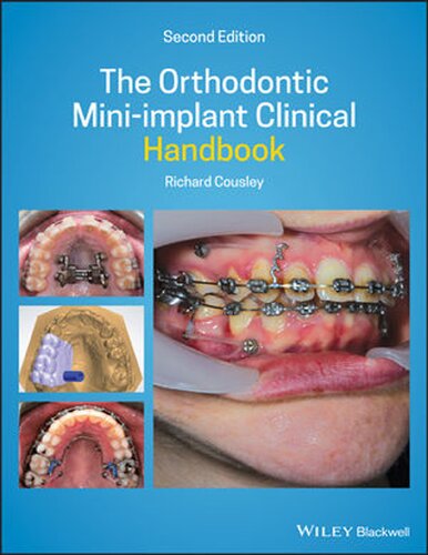 The Orthodontic Mini-implant Clinical Handbook 2020