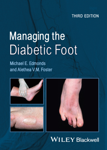 Managing the Diabetic Foot 2014