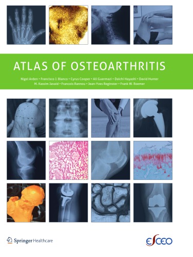 Atlas of Osteoarthritis 2015