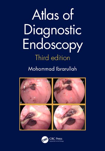 Atlas of Diagnostic Endoscopy, 3E 2019