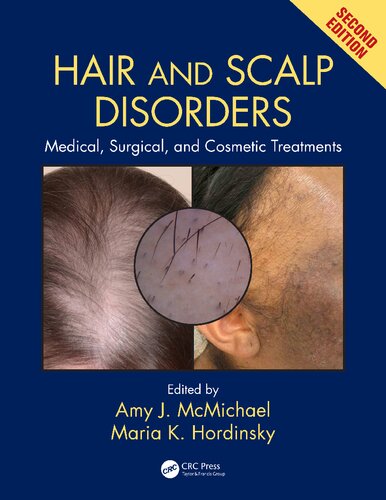 Hair and Scalp Disorders: Medical, Surgical, and Cosmetic Treatments, Second Edition 2018