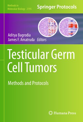 Testicular Germ Cell Tumors: Methods and Protocols 2020