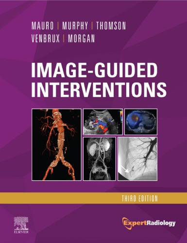 Image-Guided Interventions: Expert Radiology Series 2020