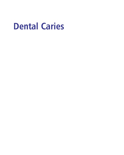 Dental Caries: The Disease and Its Clinical Management 2008