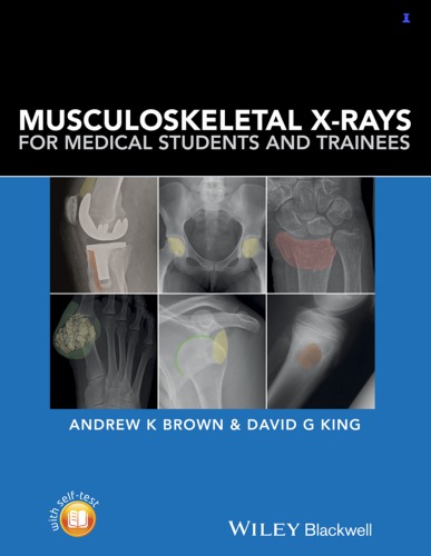 Musculoskeletal X-Rays for Medical Students and Trainees 2016