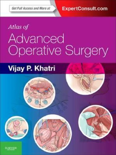 Atlas of Advanced Operative Surgery 2012