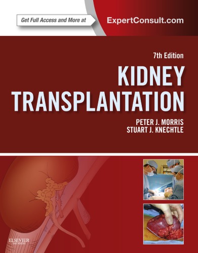 Kidney Transplantation: Principles and Practice 2013