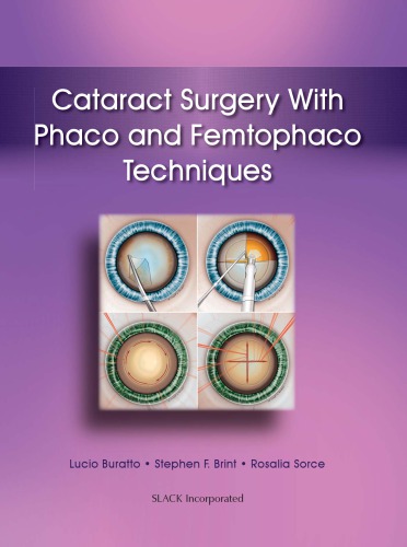 Cataract Surgery with Phaco and Femtophaco Techniques 2014