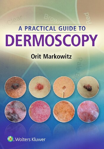 A Practical Guide to Dermoscopy 2016