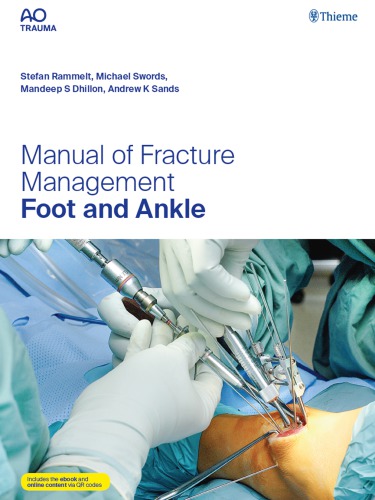 راهنمای درمان شکستگی - پا و مچ پا ۲۰۱۹
